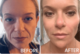 Face Eyelid Lifting Tape
